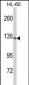 C5 Antibody (N-term)